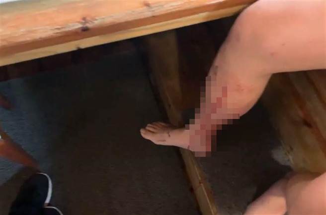 爆料女子的丈夫脚被铁钉刺伤流血。（翻摄PTT）