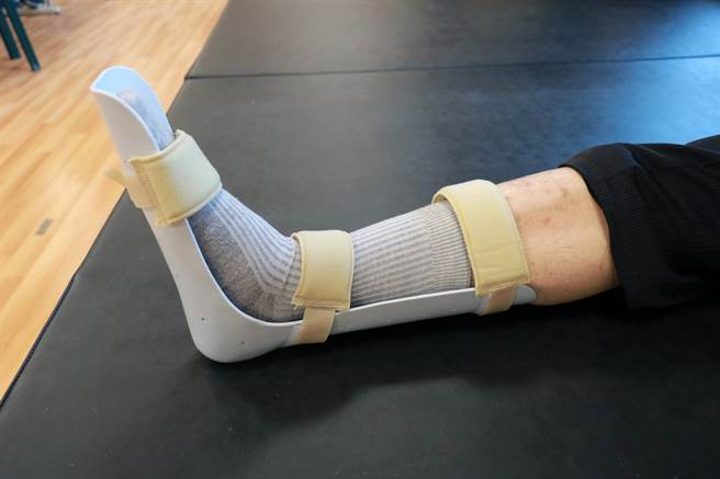 台中慈济医院復健科医师李信贤建议晚间睡眠时穿戴固定夹板，让筋膜维持较长距离下修补。（台中慈济医院提供／王文吉台中传真）