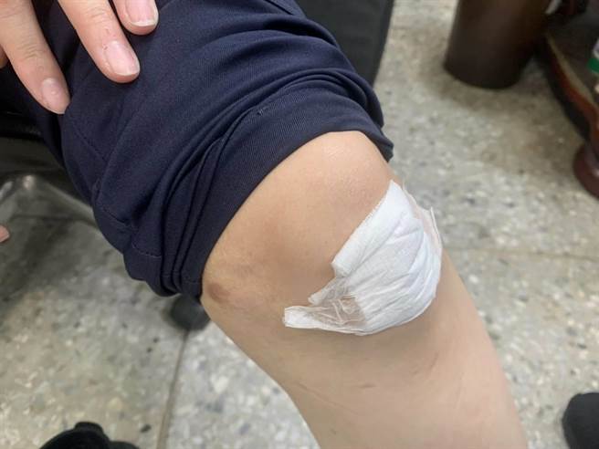 呂姓婦人騎車衝撞員警、還以腳踢，導致警察腹部挫傷及雙側膝部擦挫傷，就醫後無大礙。（翻攝照片／賴佑維桃園傳真）