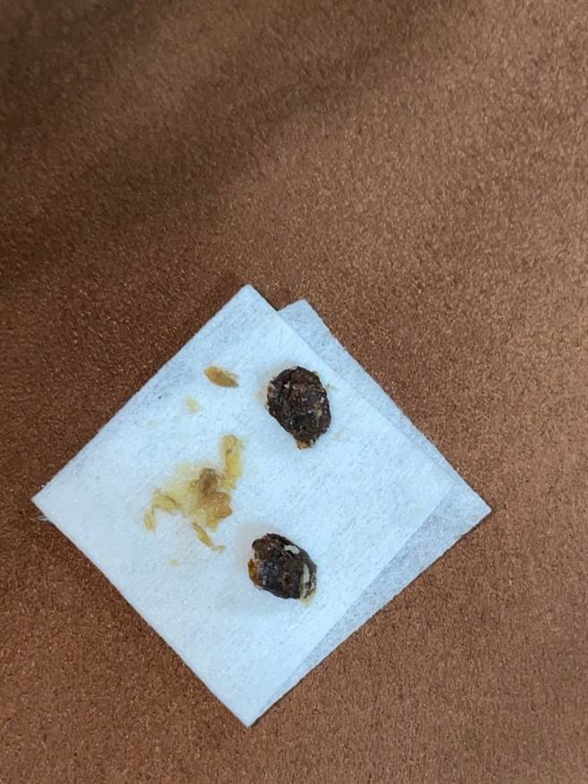 一名女网友的妹妹已经8年没有清理耳朵，没想到近日却掏出2块犹如「葡萄乾」大小的深褐色耳垢。（图／翻摄自Dcard）