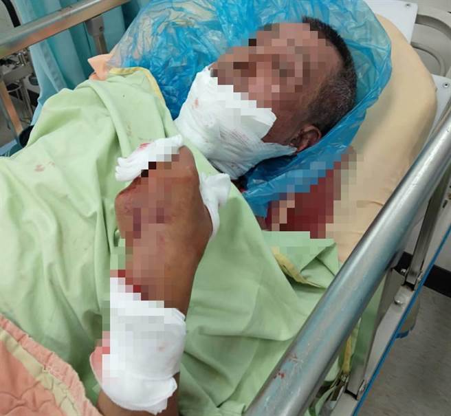 台南市官田區12日下午驚傳兄持大鐮刀砍殺弟弟的案件，弟弟經救治脫離險境。（讀者提供／張毓翎台南傳真）