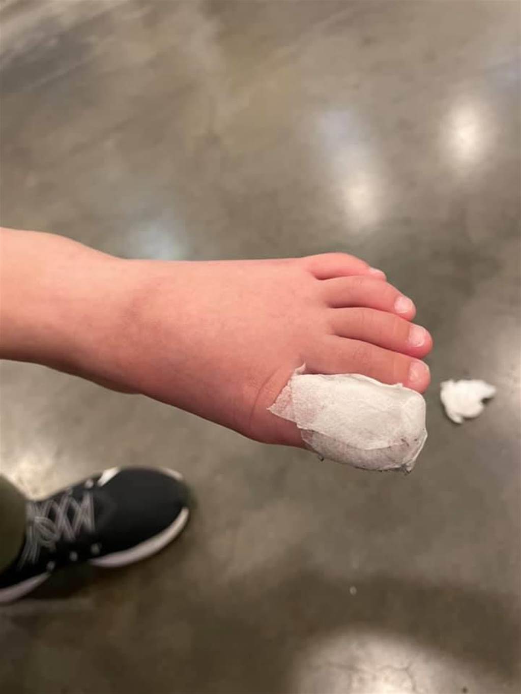 一位母親14日帶著2歲女兒前往新莊一處賣場消費，不料女兒卻遭手扶梯夾傷左腳腳趾，造成大拇指撕裂傷。（翻攝臉書社團《爆料公社》）