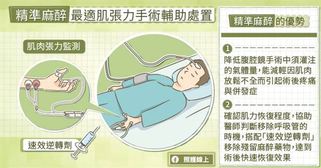 精准麻醉OMT，提升手术安全性。(图/照护线上提供)