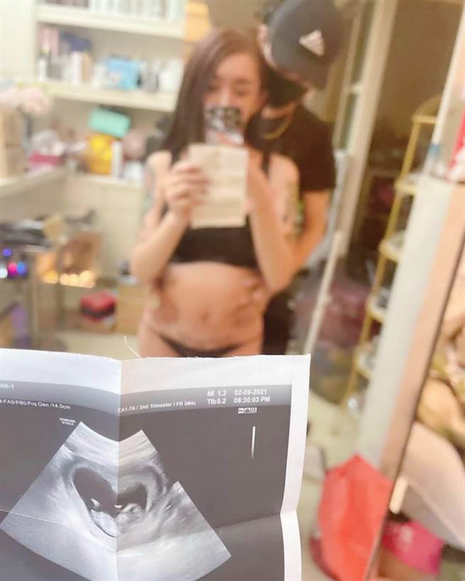 网红「罔腰」自曝有孕，高市卫生局今天将派员到高医调查，结果出炉并无不法。（柯宗纬翻摄）