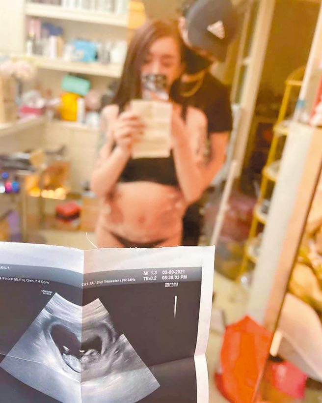 網紅「罔腰」自曝有孕，高市衛生局20日派員到高醫調查，結果出爐並無人體試驗懷孕情節。（擷取罔腰IG／柯宗緯高雄傳真）