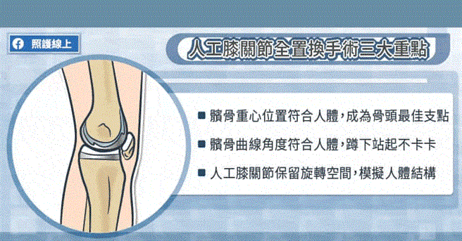 人工关节置换三大重点。(图/照护线上提供)