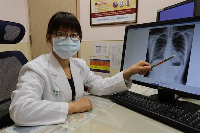 亚大医院胸腔内科主治医师陈铃宜指出病灶处。(林欣仪摄)