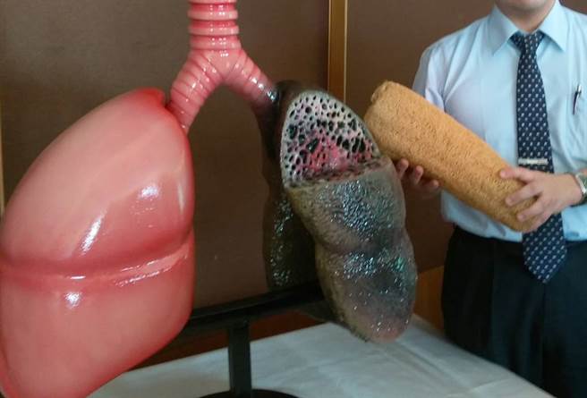 就目前医疗现况而言，肺纤维化是不可逆并且持续恶化的疾病，当发现异常喘咳时，不要轻忽。(图/本报系资料照片)