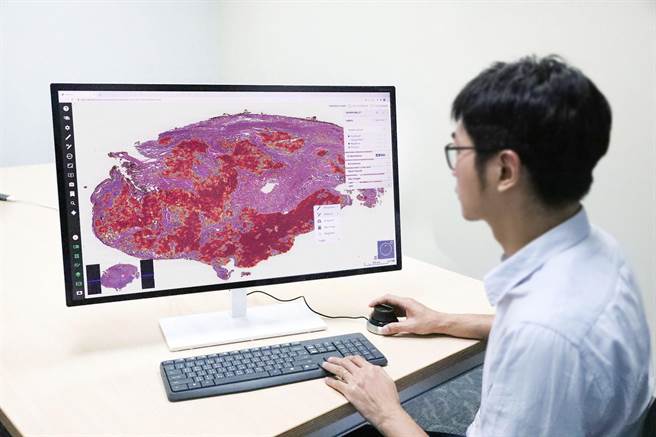 人工智慧辅助病理科医师诊断。（北医大提供）