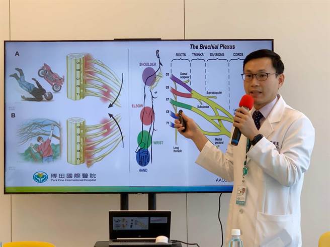 博田国际医院骨科医师吕俊宽指出，透过「神经转移手术」，让好的神经接到坏的神经，以恢復小恩的手部功能。（柯宗纬摄）