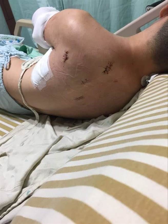 施姓男子遭刺4刀，左侧胸壁穿刺伤、左上臂神经及肌肉受损。（翻摄照片／陈彩玲基隆传真）