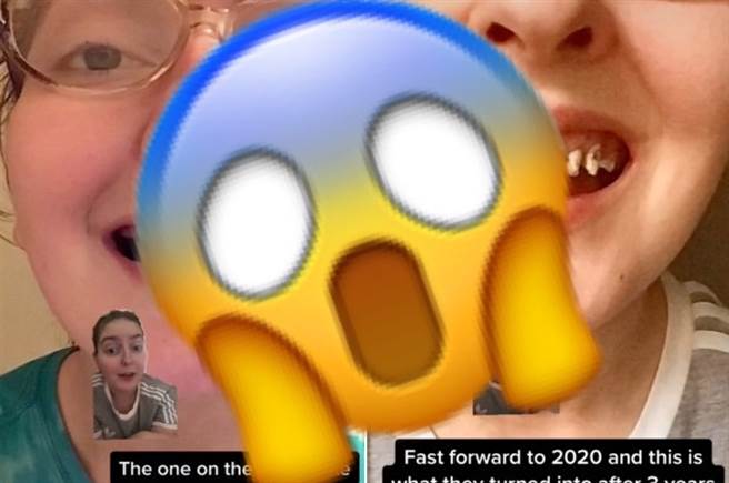 美國一名女子10年來天天喝汽水又不愛刷牙，讓她上排牙齒爛光。(圖翻攝自紐約郵報)