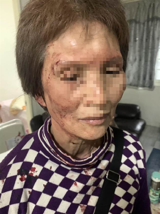 新庄租屋纠纷　女房东与越南籍女房客互殴　女房东脸部挂彩缝三针(翻摄自脸书我是新庄人许明伟／戴上容新北传真)