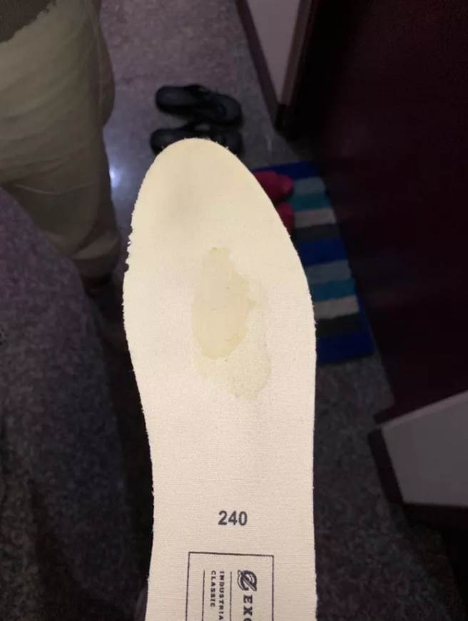女网友PO出鞋垫，上面有明显的黄色水渍。(图/截自Dcard)