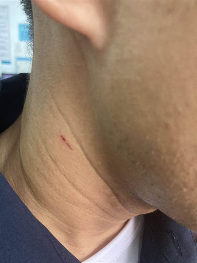 值勤员警遭抓伤脖子。（民眾提供／王文吉台中传真）