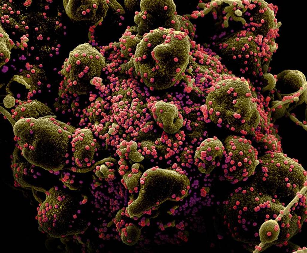 研究表示，去年9月首度在英国发现的新冠肺炎变异株B.1.1.7，致死率较前几个病毒株高出30%到100%。图/路透社(photo:ChinaTimes)