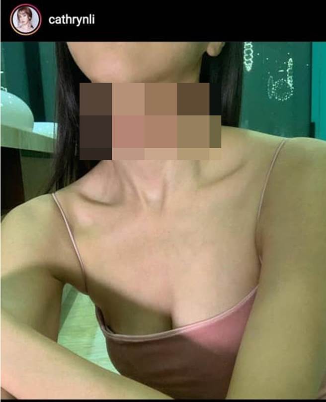 李元玲晒出脖子伤疤照片秒删。（图／翻摄自cathrynli IG）