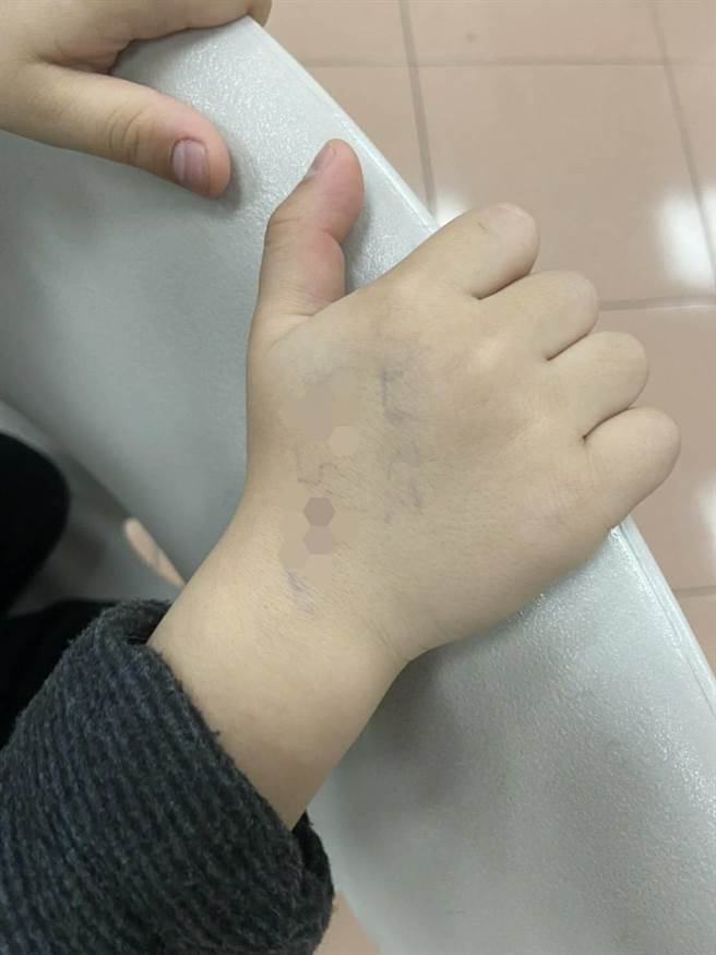 母逛街开玩笑把手机号码写3岁童手背，男童真的走失，靠手背上电话号码回到妈妈怀抱。(翻摄照片／蔡依珍桃园传真)