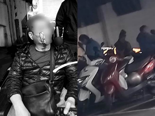 网友的父亲本月6日上前劝说桥下醉汉小声点，竟遭对方一伙人围殴，他因坐在轮椅上行动受阻，被打到眼镜破裂，镜片甚至插进眼睛。（图／翻摄自脸书爆料公社）