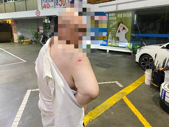 计程车司机右手臂突然遭到疑似钢珠射击，手臂当场破皮爆血，他当下还以为是店员乱打人，后来才知遭钢珠弹射击。（警方提供）