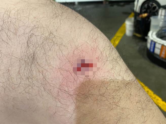 计程车司机右手臂突然遭到疑似钢珠射击，手臂当场破皮爆血，他当下还以为是店员乱打人，后来才知遭钢珠弹射击。（警方提供）