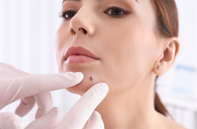 女人脸上有3大部位若是长痣，就代表十分多情，一旦风流起来绝对不会输给男人。（图／Shutterstock）