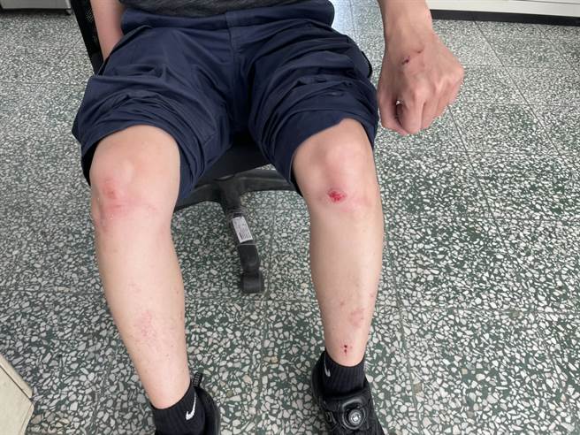 派出所長在逮捕賴嫌過程中遭抗拒咬傷，仍負傷逮嫌犯。(警方提供)
