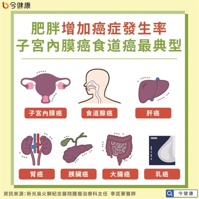 肥胖增加癌症发生率，其中又以子宫内膜癌与食道癌最典型。(图/今健康提供)