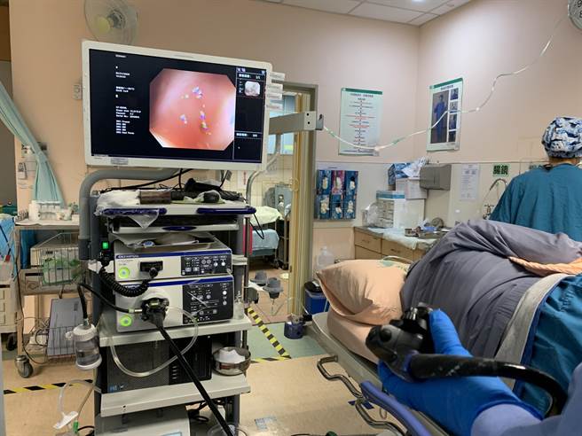 以往大肠癌患者多是中老年人，不过随生活型态改变，近年不少30至40岁年轻人罹病。医师强调，罹患大肠癌存活率关键在于「发现的期别」，透过定期检查，越早发现治癒率越高。（门诺医院提供／罗亦晽花莲传真）