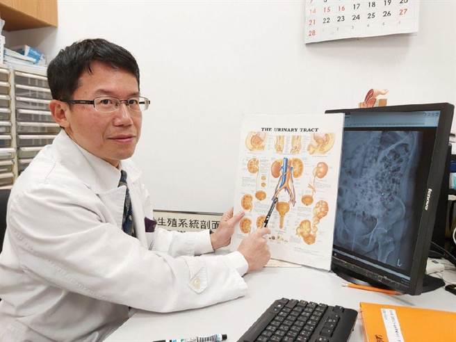 三峡恩主公医院副院长王炯珵表示，院内近期引进永久性支架「可自我膨胀镍钛合金」输尿管置入技术，可有效解决尿路狭窄问题。（恩主公医院提供）