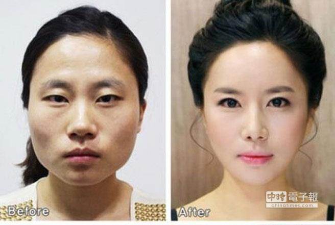 整形是否可以改运?网红命理师表示圆润饱满的脸型，属于富贵之相。(图/本报资料照)