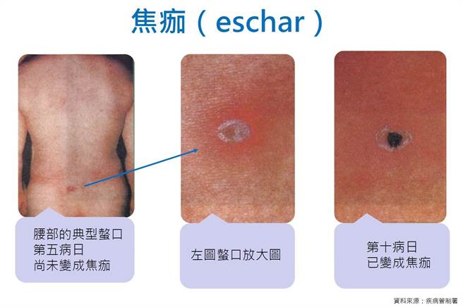 桃園市衛生局呼籲民眾出入郊區、山區時應注意防護。（桃園市衛生局提供）