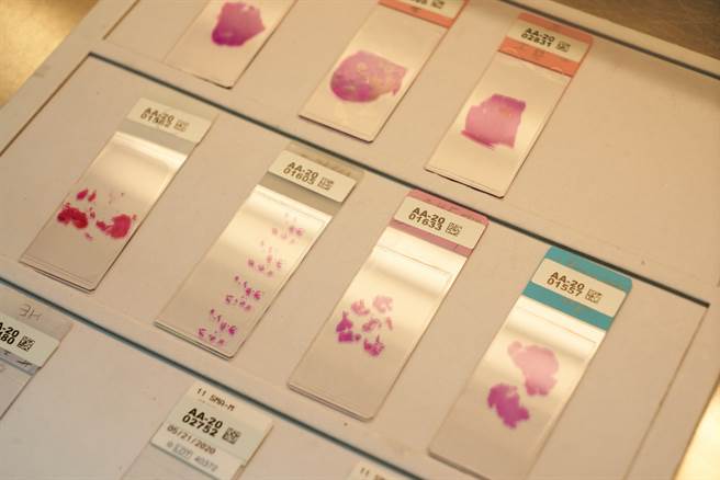 治疗型癌症基因检测透过次世代基因定序，用一次检测就能找出400种以上与癌症有关的基因突变，可获得完整治疗资讯也能避免检体浪费。(图/行动基因提供)

