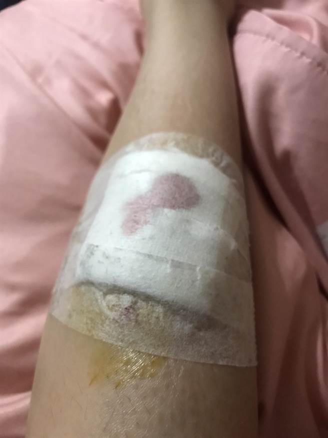 女童遭鏽蝕鏤空水溝蓋的尖銳鐵片割傷。(市議員王立任提供)