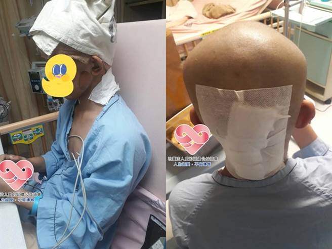新北市淡水区1名少年「小宇」7岁时被诊断头部罹癌，至今已3度復发，如今癌细胞扩散到眼球、眼骨与脑部，他说「不想成为只剩半张脸的怪人」。（图／翻摄自脸书「社团法人爱的延续公益协会」）