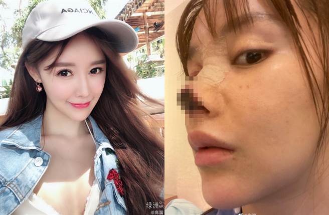 高溜外貌甜美却整形失败。（图／翻摄自高溜微博）