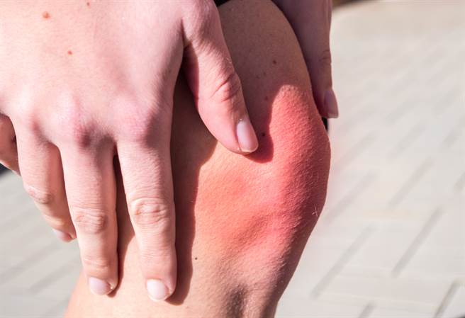 退化性膝关节炎别急着开刀，中医师建议，先试一试中药、针灸治疗或是伤科手法调整结构等治疗方法。(示意图/常春月刊提供)