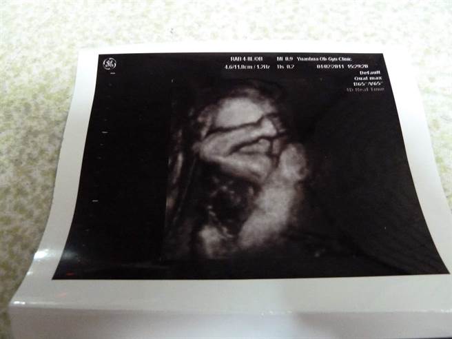 军人爸爸张先生分享，10年前妻子怀孕时，他发现儿子竟在妈妈肚中大秀肌肉线条，做起仰卧起坐。(摘自爆废1公社)