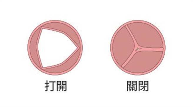 正常主動脈瓣膜。（國泰醫院提供）