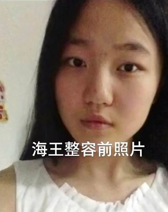 項思醒整形前照片瘋傳。(取自微博)