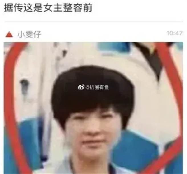 項思醒整形前照片瘋傳。(取自微博)