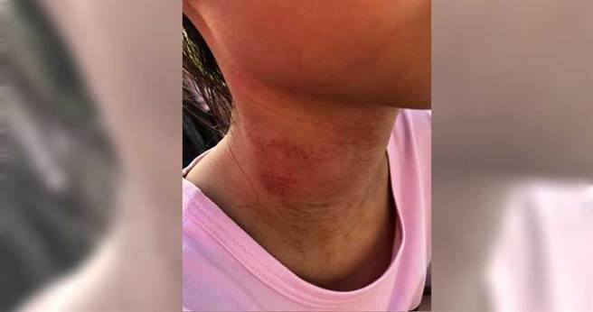 苗栗县新开幕的湾丽亲子公园竟发生意外，一名女孩玩滑梯时，竟遭粗绳勒脖。（图／翻摄自苑里心连心脸书）