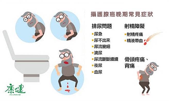 摄护腺癌常见症状。(图/康健杂志提供)