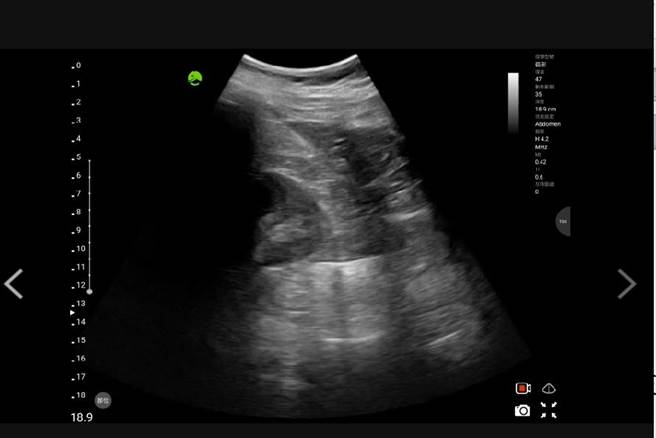 云林县消防局救护人员为提早确认伤患是否有出血现象，首次使用院前超音波扫描，并上传医师群组判读。（云林县消防局提供）