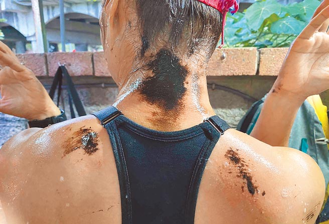 高雄西子灣18日有10餘名泳客上岸後竟成了「黑人」，原來是全身都沾滿黑色油漬。 （翻攝照片／劉宥廷高雄傳真）