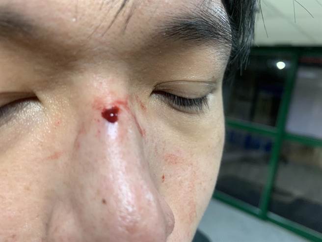 18岁锺姓男子等3人涉嫌网路贩毒于24日凌晨遭逮，锺嫌不满遭逮反而殴伤李姓警员，造成他鼻骨骨折、脸部擦挫伤。（翻摄画面）