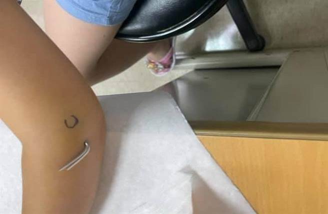 高雄一名5岁女童在校跑步跌倒造成骨裂，医生第一时间却不给照X光，让女童妈妈不禁质疑医生耽误就医。（图／脸书社团《爆料公社》）