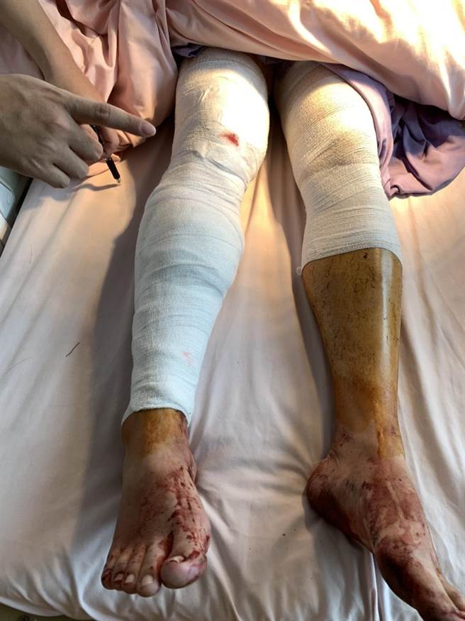 4名傷者送往金門醫院治療，其中1人傷勢嚴重。（民眾提供）