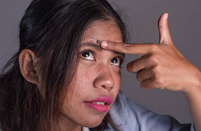 眉毛长痣有「眉里藏珠」之意，会得到贵人的帮助与提携，一生必定非富即贵。（图／Shutterstock）
