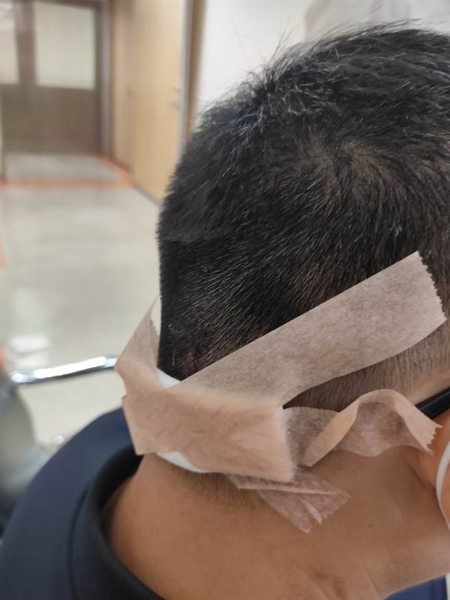 高雄街头爆袭警案 男子持铁鎚攻击交警头部溅血 行凶后逃逸 (警方提供)
